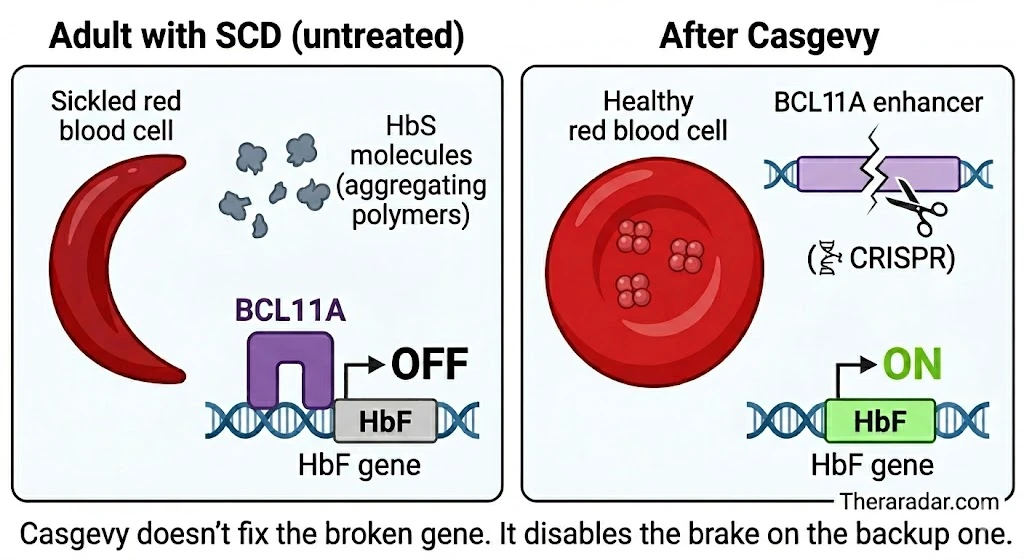 Side-by-side diagram — untreated sickle cell disease (left): BCL11A protein shuts off the HbF gene while HbS polymerizes and deforms the red blood cell into a sickle shape. After Casgevy (right): CRISPR cuts the BCL11A erythroid enhancer, HbF gene reactivates, red blood cell shape is restored.