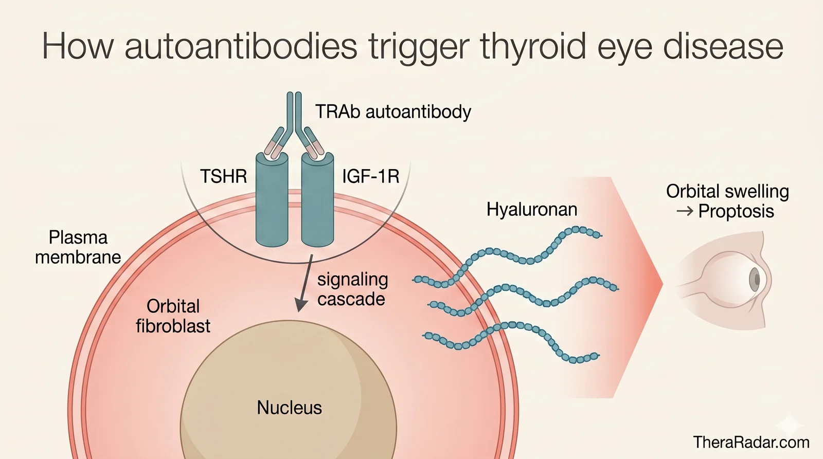 Mechanism of thyroid eye disease: TRAb autoantibody binds the TSHR/IGF-1R complex on an orbital fibroblast, activating a signaling cascade that drives hyaluronan production and downstream orbital swelling (proptosis).